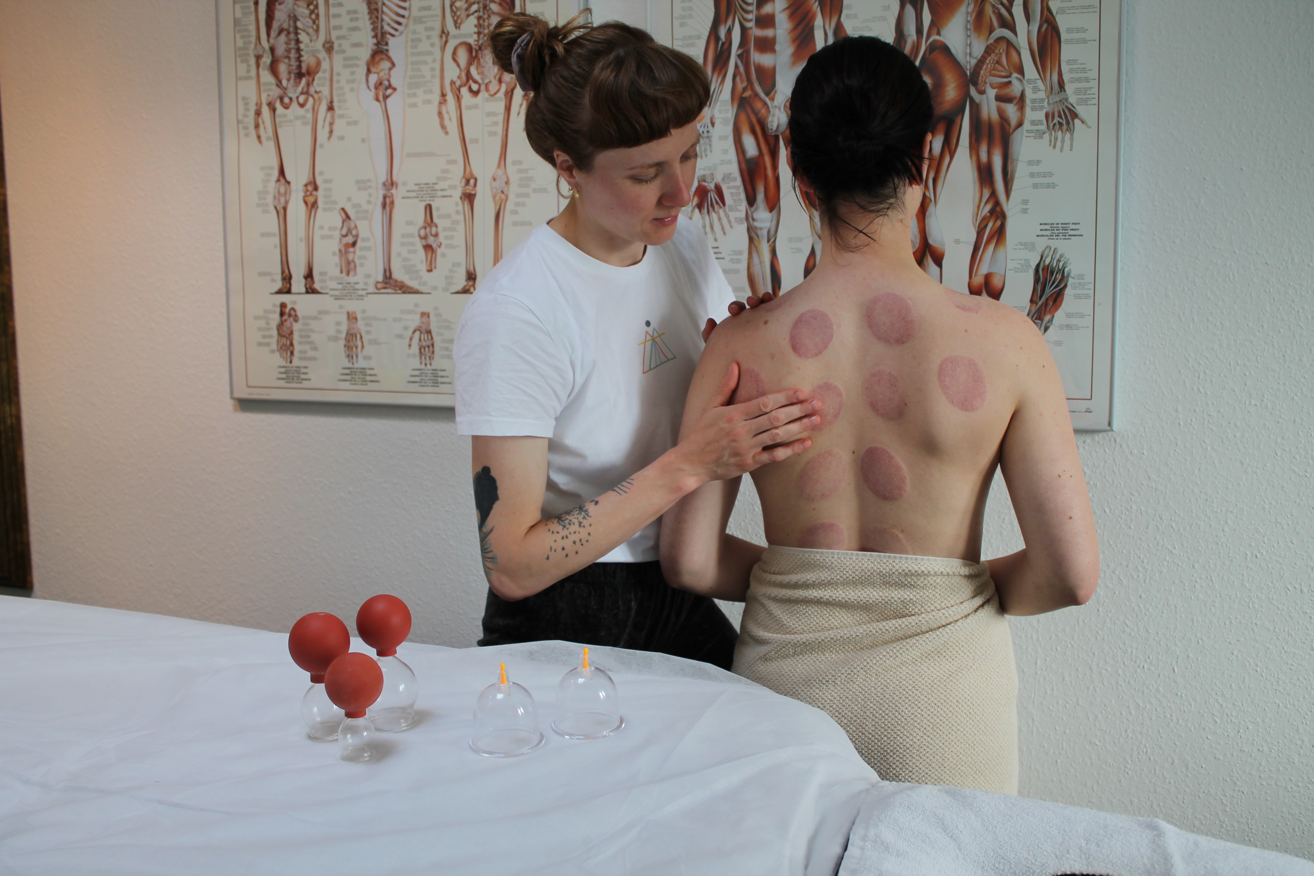 Behandling med cupping terapi hos Körperli massage og kropsterapi